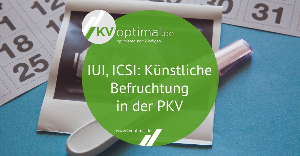IUI, ICSI: Künstliche Befruchtung in der PKV